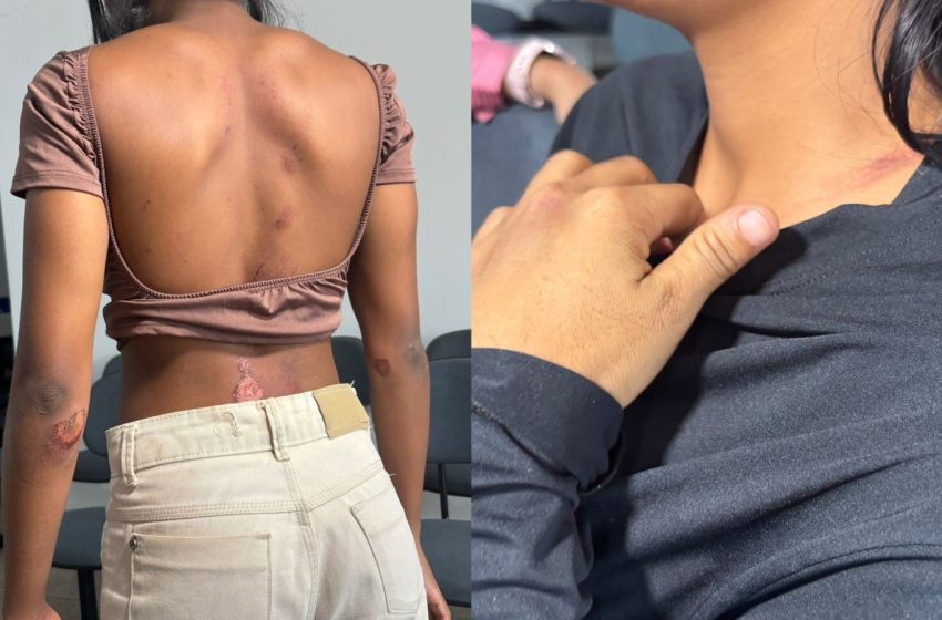  Jovens atropeladas no Amapá acusam motorista de racismo: ‘Pensei que ia morrer’